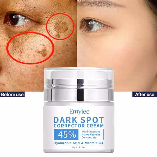 Private Label Dark Spot Remover TCA Anti Wrinkle Serum Acid Melasma Peeling