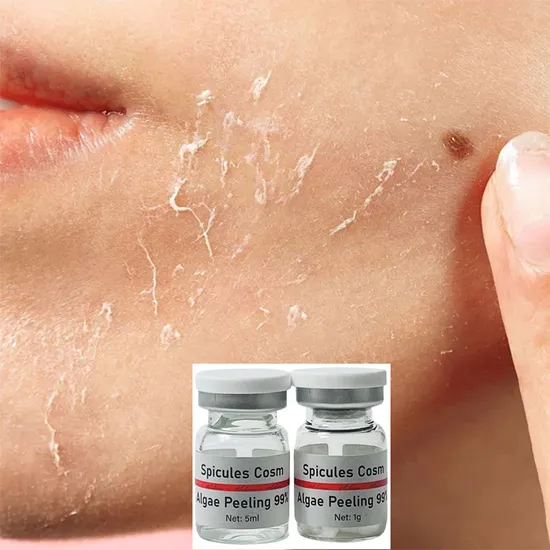 Customized Logo 99% Spongilla Spicule Algae Peel Skin Strong Peeling Remove Acne Marks Pigmentation Exfoliation 2025g 